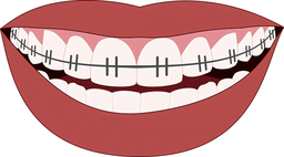 braces, Looking after your braces